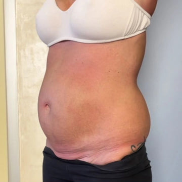 Testimonio visual